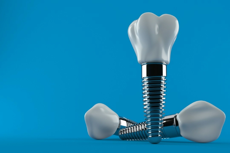 implanty dentstyczne